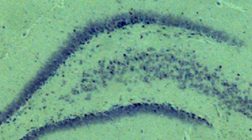 High expression of cytochrome b5 reductase isoform 3/cytochrome b5 system in the cerebellum and pyramidal neurons of adult rat brain
